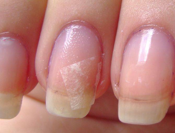 Foto: Konadnails.blogspot.com